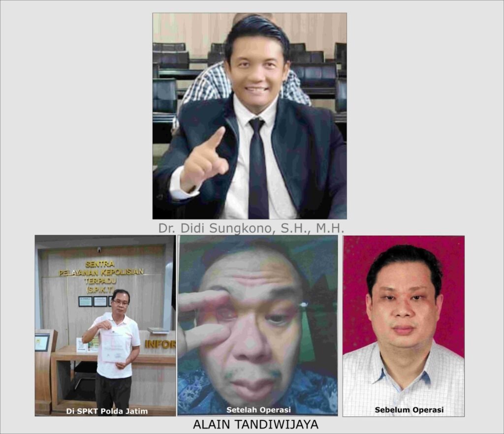 Operasi Mata Dokter RSMM Jatim ke Meja Hukum 2 WhatsApp Image 2026 01 06 at 8.26.02 AM 1